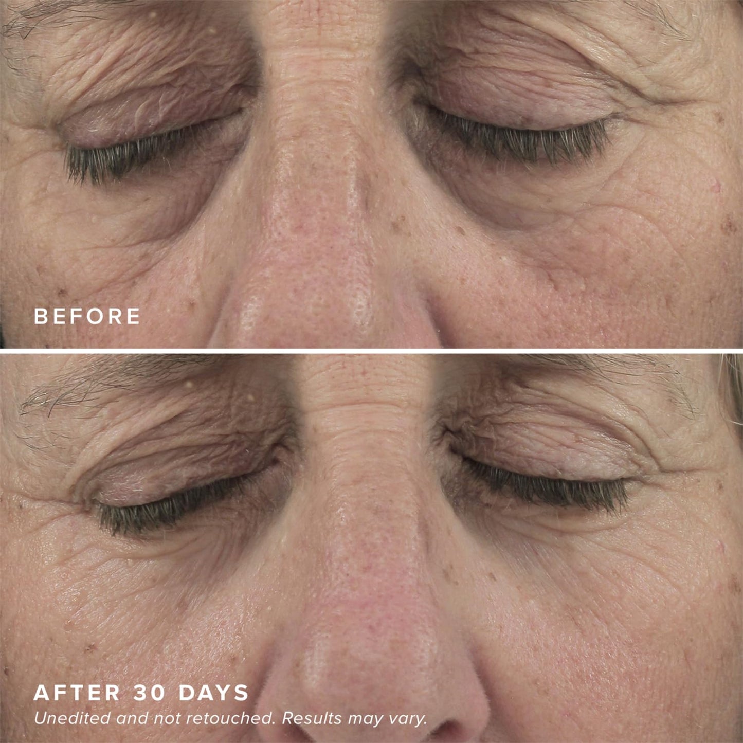 Caffeine & Collagen Infused Brightening Eye Masks