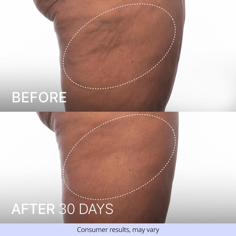 Firming Butt & Thigh Cream