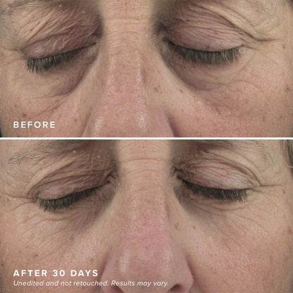 Caffeine & Collagen Infused Brightening Eye Masks