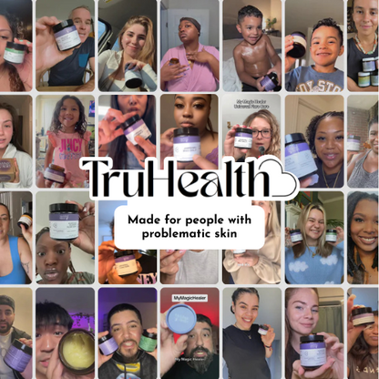 Universal Flare Care